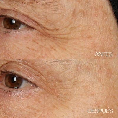 Clinique — Ночной крем-маска Smart Clinical Repair 4