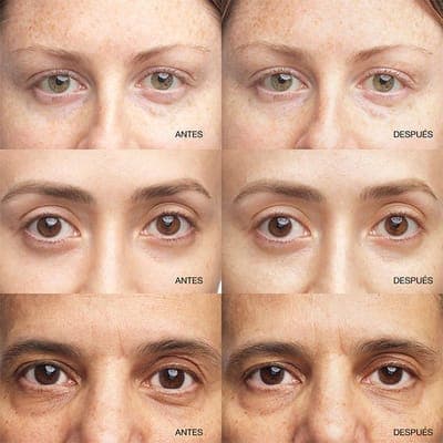 Clinique — Сыворотка для контура глаз All About Eyes 4