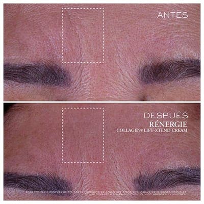 Lancôme — Крем Rénergie Collagen Lift-Xtend 4